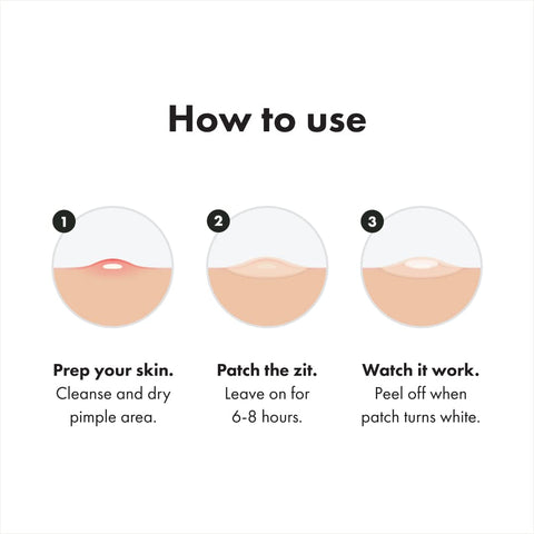 Mighty Patch™ Original patch from Hero Cosmetics - Hydrocolloid Acne Pimple Patch for Covering Zits and Blemishes in Face and Skin, Vegan-friendly and Not Tested on Animals (36 Count) Mighty Patch