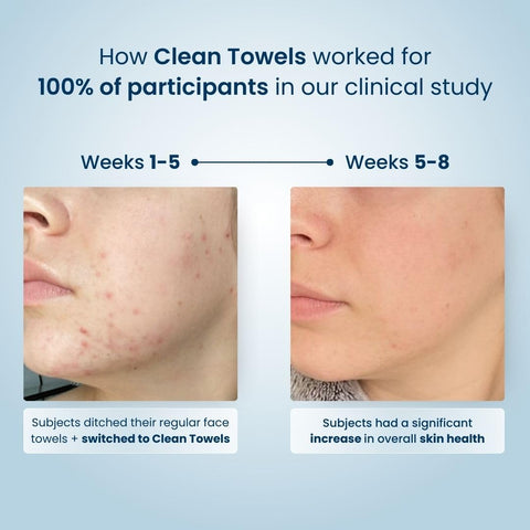 Clean Skin Club Clean Towels XL™, 100% USDA Biobased Face Towel, Disposable Face Towelette, Eczema Association Accepted, Makeup Remover Dry Wipes, Ultra Soft, 50 Ct, 1 Pack CLEAN SKIN CLUB
