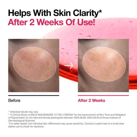 ANUA Niacinamide 10 + TXA 4 Serum, Hyaluronic Acid, Tranexamic acid, Facial Serum For GlassSkin, Glow Back Serum, Dark Spot Care, Postnatal Skincare, Korean Skincare (30ml/1.01 fl.oz)