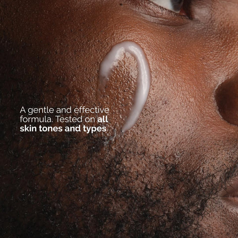 The Ordinary Niacinamide 5% Face and Body Emulsion, Dark Spot & Skin Tone Corrector, 3.4 Fl Oz