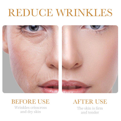 Collagen Skin Care Set, 6Pcs Anti Aging Face Care Sets for Women, Firming Skin, Shrink Pores, Smooth Wrinkles, Hydrating Skin Care Set Include Serum Face Cream Eye Cream Toner Cleanser Facial Mask1