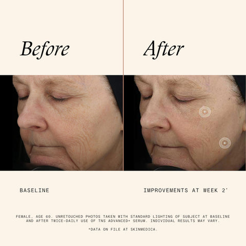 SkinMedica TNS Advanced+ Serum - Our Premium Facial Skin Care Product, the Secret to Flawless Skin. Age-Defying Face Serum for Women is Proven to Address Wrinkles and Fine Lines for Glowing Skin,1 Oz