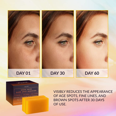 VALITIC Kojic Acid Dark Spot Remover Soap Bars with Vitamin C, Retinol, Collagen, Turmeric - Original Japanese Complex Infused with Hyaluronic Acid, Vitamin E, Shea Butter, Castile Olive Oil (2 Pack) VALITIC