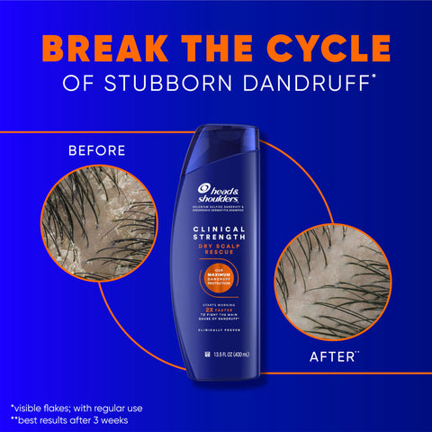 Head & Shoulders Anti-Dandruff Shampoo, Clinical Strength Dry Scalp Rescue Shampoo Twin Pack, 1% Selenium Sulfide, Seborrheic Dermatitis Relief, Dry Scalp 13.5 fl oz Each