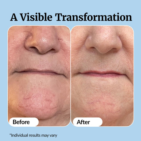 Vibriance Super C Serum for Mature Skin - All-in-One Vitamin Formula Hydrates, Firms, Lifts, Smooths, Targets Age Spots, Wrinkles, 1 fl oz