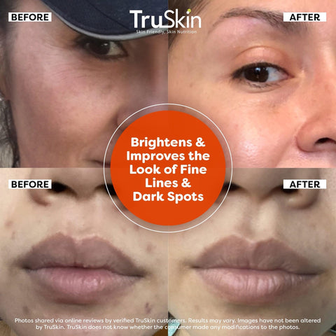 TruSkin Vitamin C Serum For Face – Anti Aging Formula with Vitamin C, Hyaluronic Acid, Vitamin E – Brightening Serum – Improve Appearance of Dark Spots, Tone, Fine Lines & Wrinkles, 2 Fl Oz TruSkin
