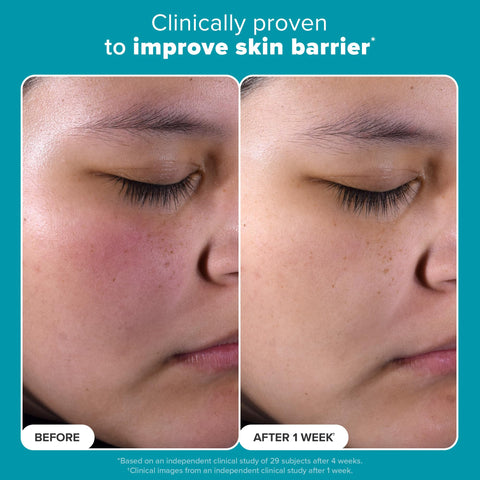 Paulas Choice--SKIN PERFECTING 2% BHA Liquid Salicylic Acid Exfoliant--Facial Exfoliant for Blackheads, Enlarged Pores, Wrinkles & Fine Lines, 4 oz Bottle Paula's Choice
