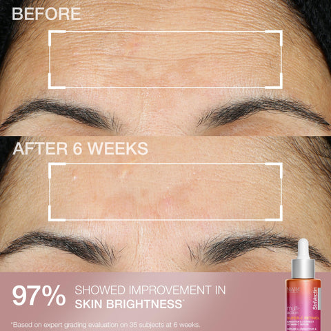 StriVectin Clinically Proven Skin Care Travel-Ready Minis 4-Piece Set